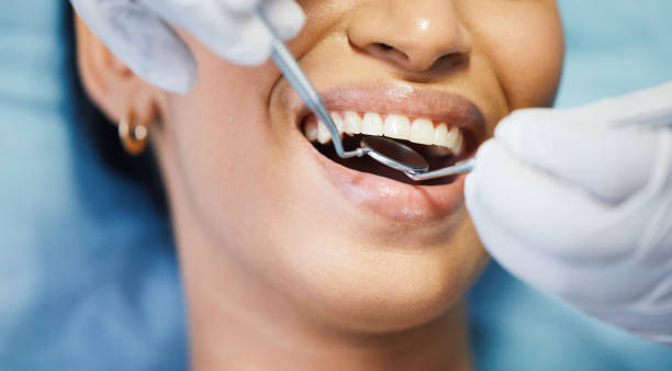 Best Knocked-Out Tooth (Avulsed Tooth) Treatment in Crest View Heights, NY
